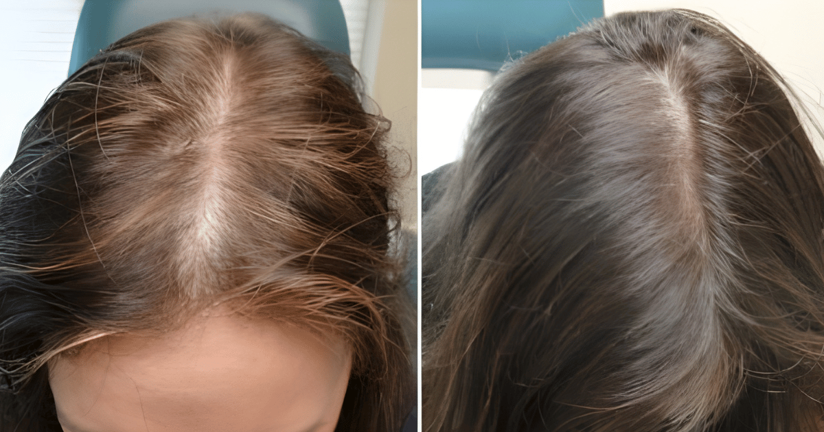 Perdita di capelli in inverno: 5 semplici abitudini per capelli forti e da sogno