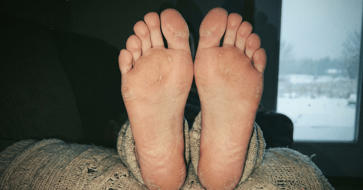 Talloni screpolati e piedi secchi? La mia routine invernale onesta, senza fronzoli, che funziona davvero